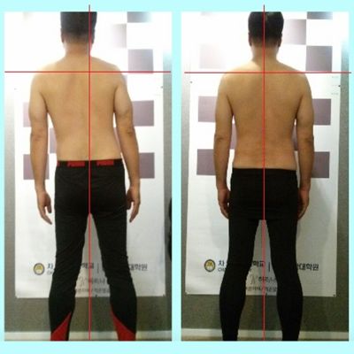 [허리나] 바른자세 코칭, 전문적인 체형 관리 (바른자세 - 목 / 어깨 허리 / 골반)